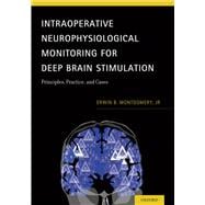 Intraoperative Neurophysiological Monitoring for Deep Brain Stimulation Principles, Practice and Cases