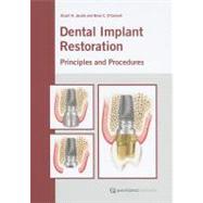 Dental Implant Restoration: Principles and Procedures