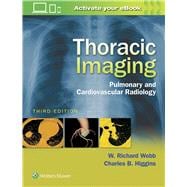 Thoracic Imaging Pulmonary and Cardiovascular Radiology