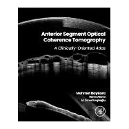 Anterior Segment Optical Coherence Tomography