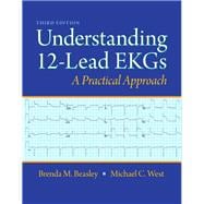 Understanding 12-Lead EKGs