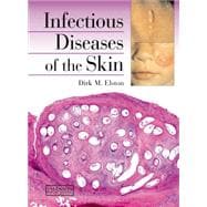 Infectious Diseases of the Skin