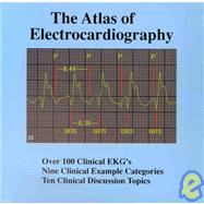 The Atlas of Electrocardiography for Windows, Student Version