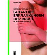Gutartige Erkrankungen der Brust