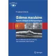 Rd?es Maculaires