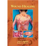 Wound Healing