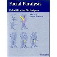 Facial Paralysis