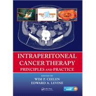 Intraperitoneal Cancer Therapy: Principles and Practice