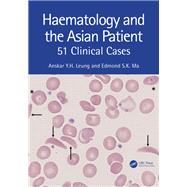 Haematology and the Asian Patient