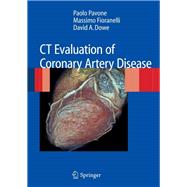 CT Evaluation of Coronary Artery Disease