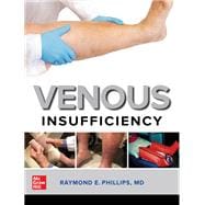 Venous Insufficiency