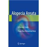 Alopecia Areata