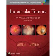 Intraocular Tumors: An Atlas and Textbook