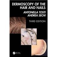 Dermoscopy of the Hair and Nails