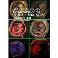 3D-Sonographie in der pränatalen Diagnostik