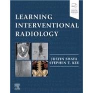 Evolve Resources for Learning Interventional Radiology