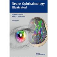 Neuro-ophthalmology Illustrated