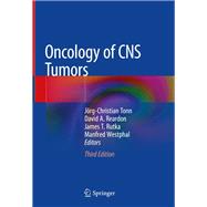 Oncology of Cns Tumors