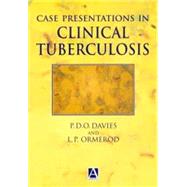 Case Presentation in Clinical Tuberculosis