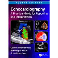 Echocardiography