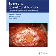 Spine and Spinal Cord Tumors