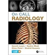 On Call Radiology