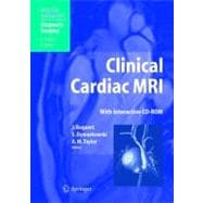 Handbook of Clinical Cardiac MRI
