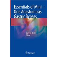 Essentials of Mini ? One Anastomosis Gastric Bypass
