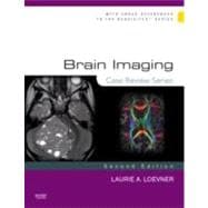 Brain Imaging
