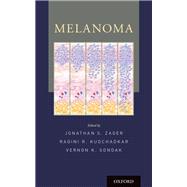 Melanoma