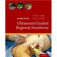 Ultrasound Guided Regional Anesthesia