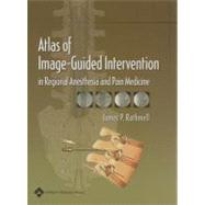 Atlas of Image-guided Intervention in Regional Anesthesia And Pain Medicine