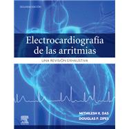 Electrocardiografía de las arritmias