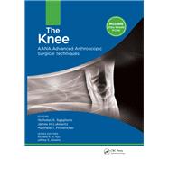 The Knee