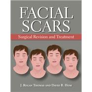 Facial Scar Revision