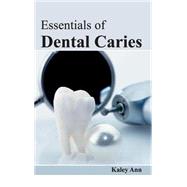 Essentials of Dental Caries