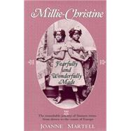 Millie-Christine Fearfully and Wonderfully Made