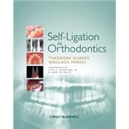 Self-Ligation in Orthodontics