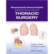 Massachusetts General Hospital Illustrated Tips and Tricks in Thoracic Surgery: Print + eBook with Multimedia