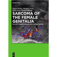 Smooth muscle and stromal tumors and prevention of inadequate surgery