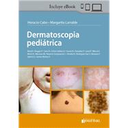 Dermatoscopia pediátrica