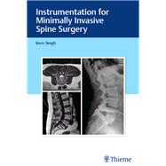 Instrumentation for Minimally Invasive Spine Surgery