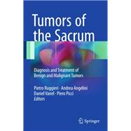 Tumors of the Sacrum