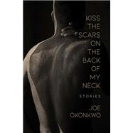 Kiss the Scars on the Back of My Neck