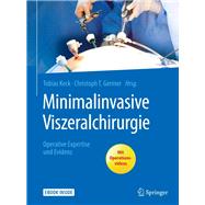Minimalinvasive Viszeralchirurgie