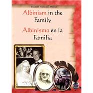 Albinism In The Family