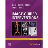 Image-guided Interventions