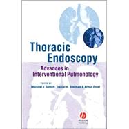 Thoracic Endoscopy Advances in Interventional Pulmonology