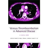 Venous Thromboembolism in Advanced Disease A clinical guide