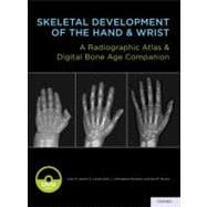 Skeletal Development of the Hand and Wrist A Radiographic Atlas and Digital Bone Age Companion